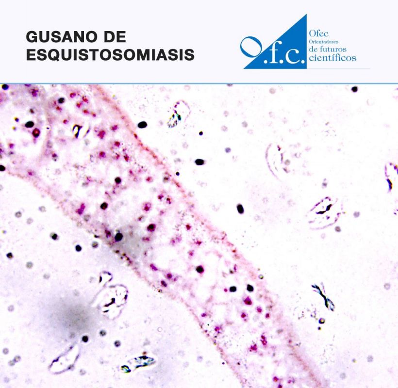 Gusano de esquistosomiasis