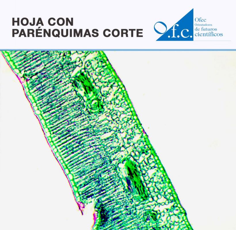 Hoja con parénquimas corte