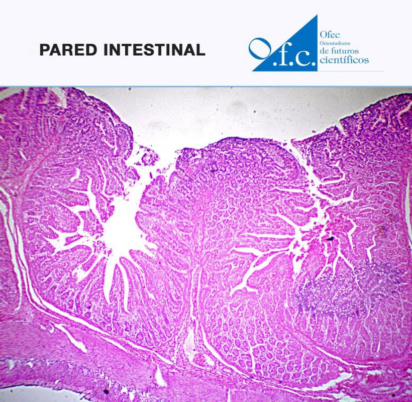 Pared intestinal