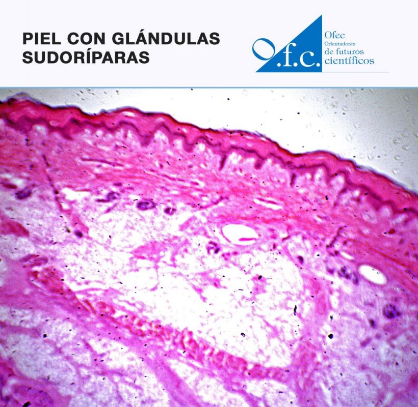 Piel con glándulas sudoríparas