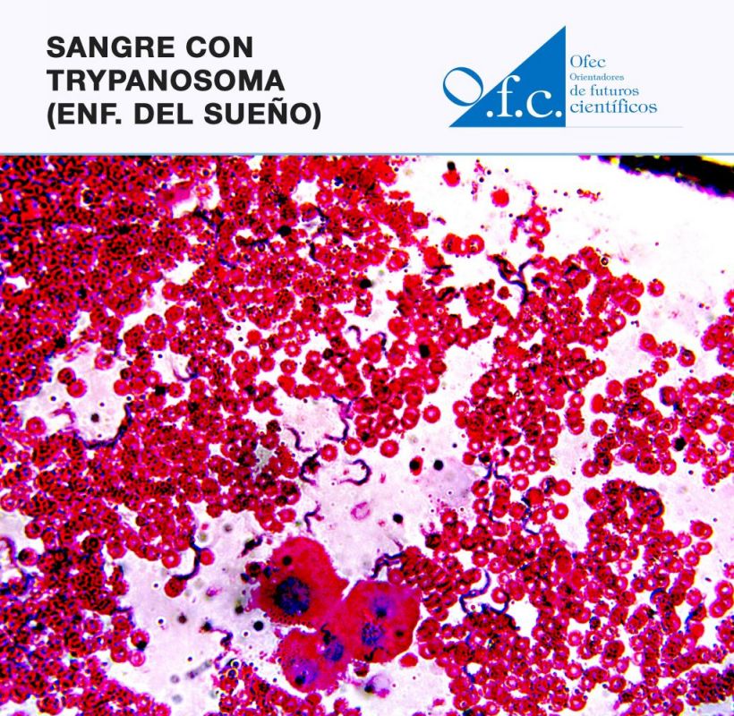 Sangre con trypanosoma (enf. Del sueño