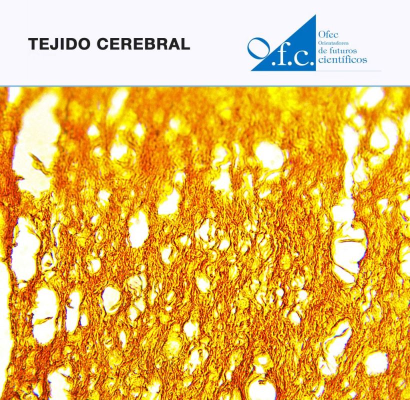 Tejido cerebral