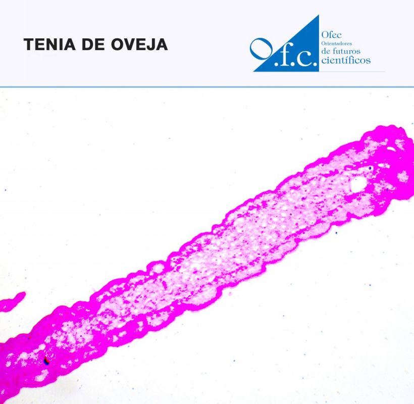 Tenia de oveja