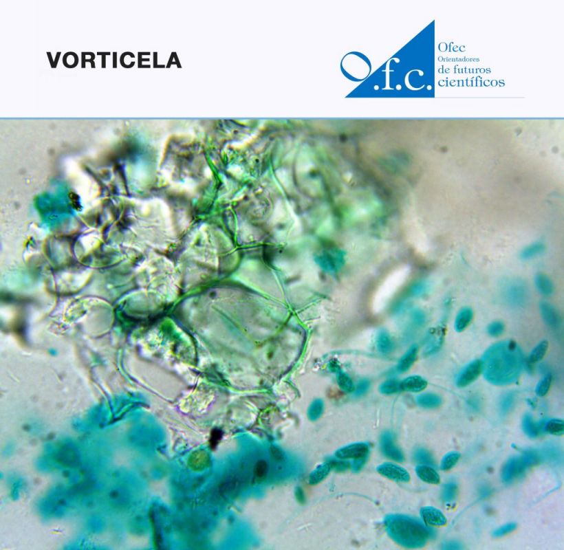 Vorticela